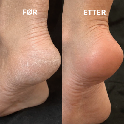 Glass Fotfil - Myke føtter på sekunder