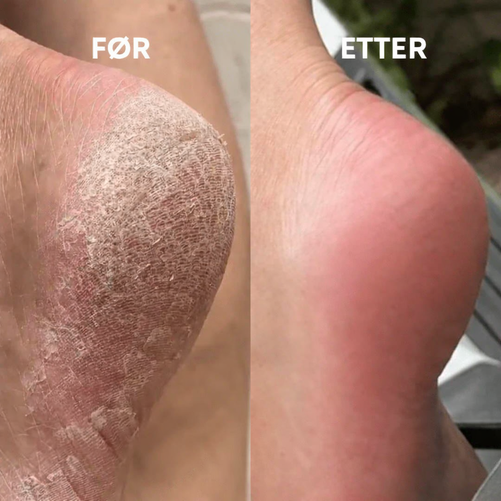 Glass Fotfil - Myke føtter på sekunder